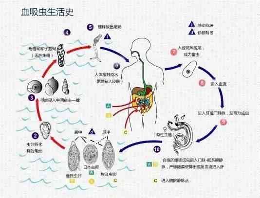 血吸虫认定工伤