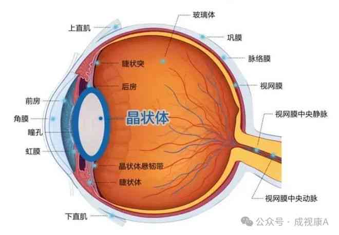 视网膜脱离可以认定工伤吗