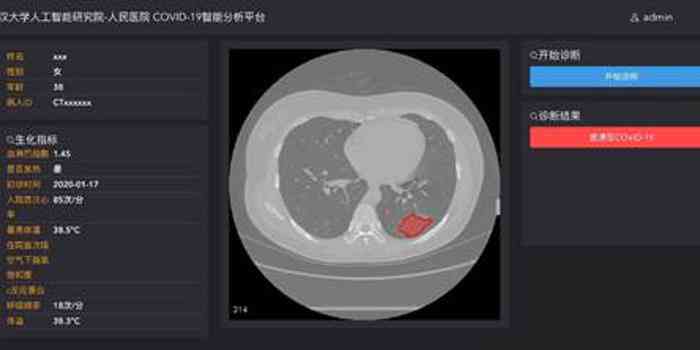 ct报告ai识别