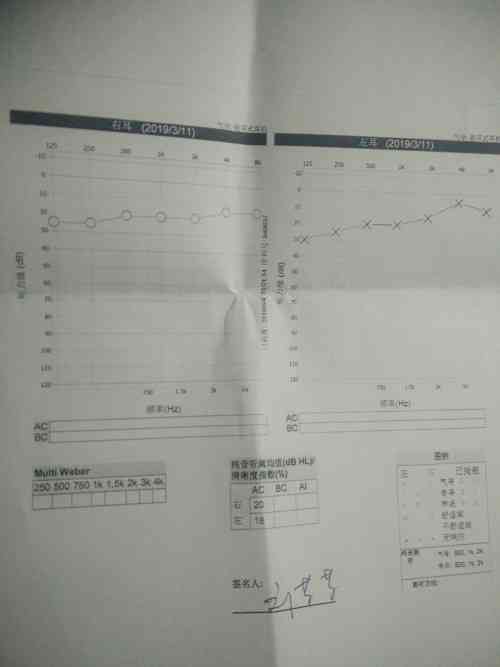 纯音听阈测试报告ai