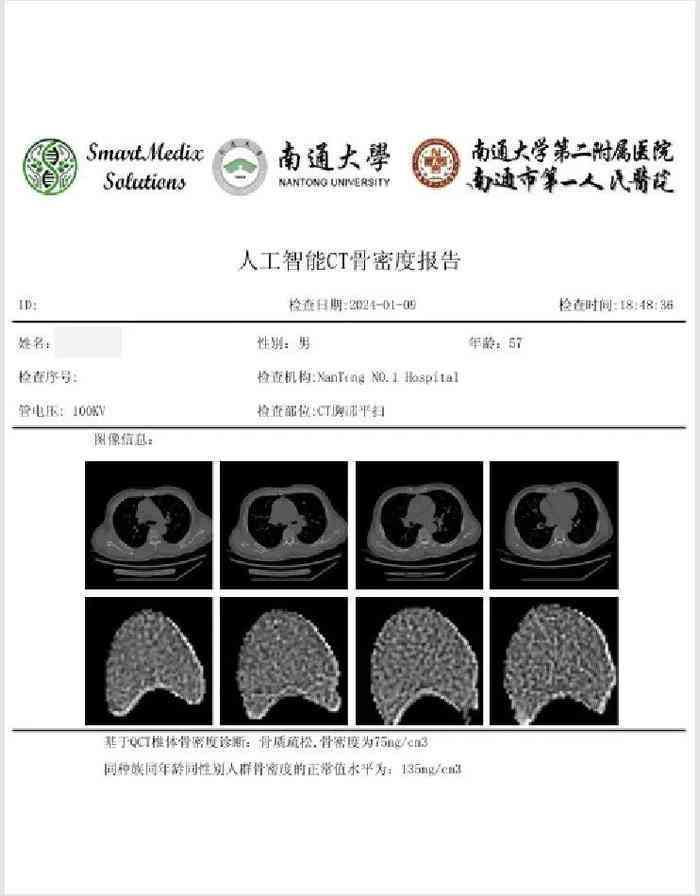 ai看ct报告