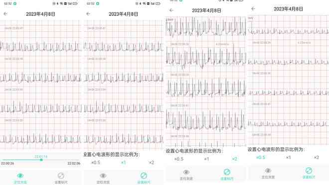 乐普ai智能分析报告