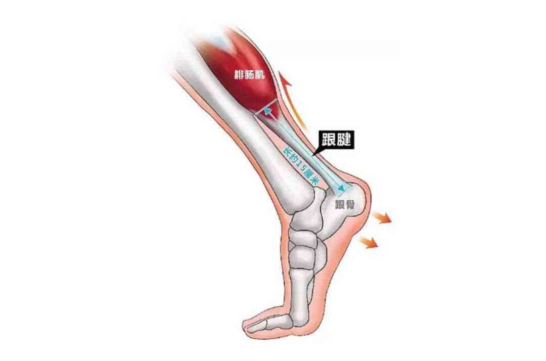 跟腱断裂能认定工伤吗