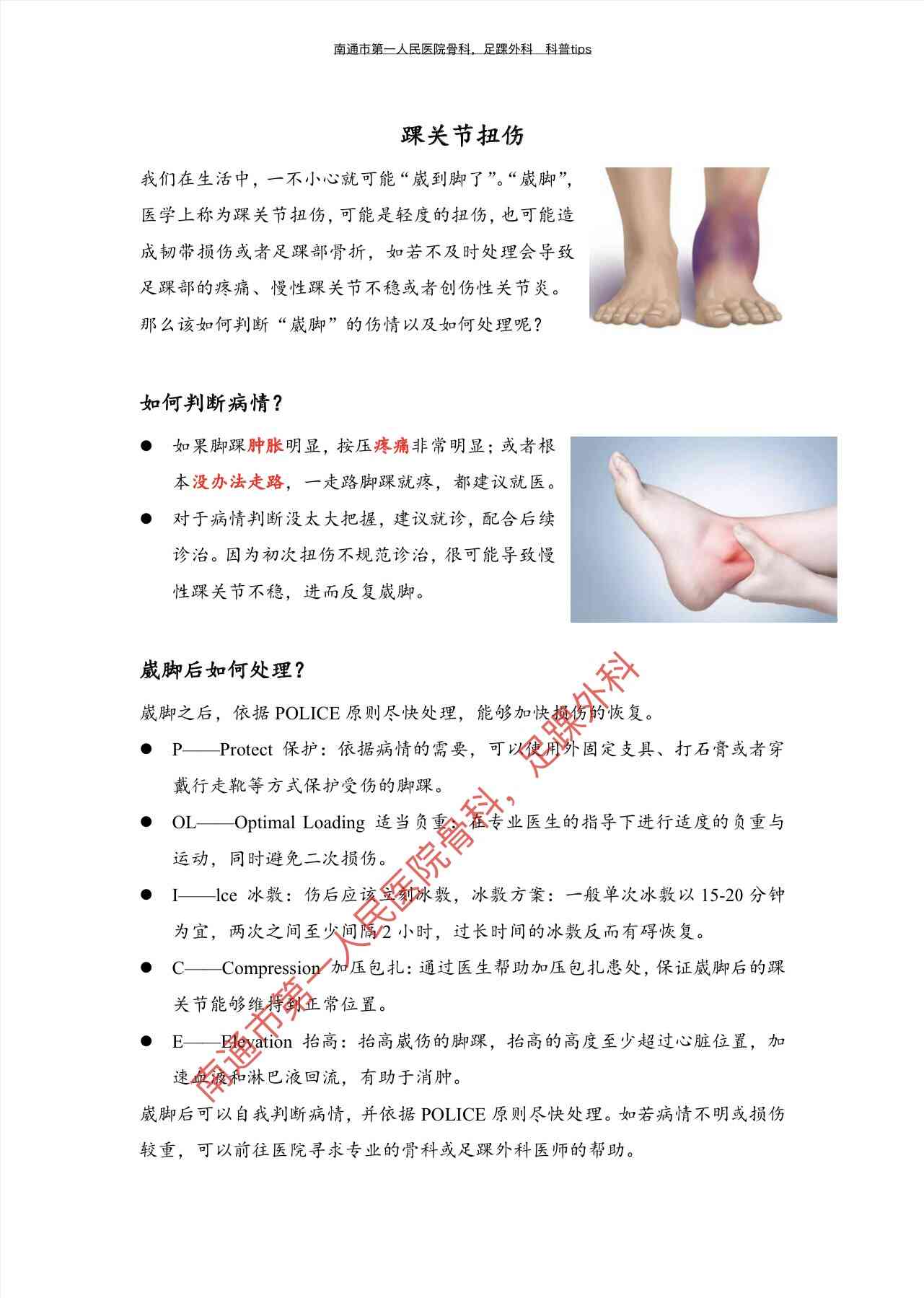 踝关节扭伤认定工伤几级