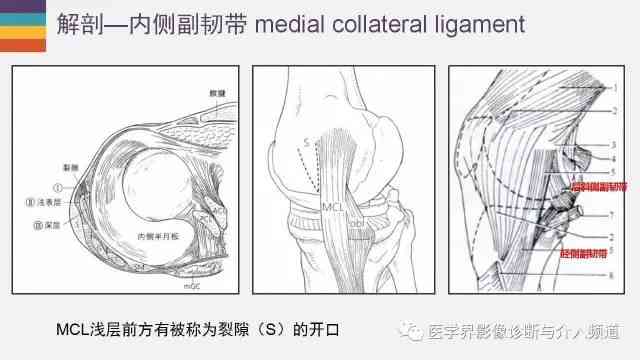 韧带损伤怎么认定工伤