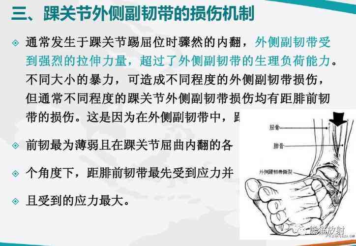 韧带损伤能认定工伤么吗