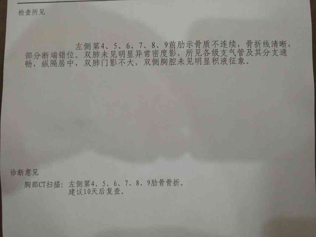 骨挫伤可认定工伤几级