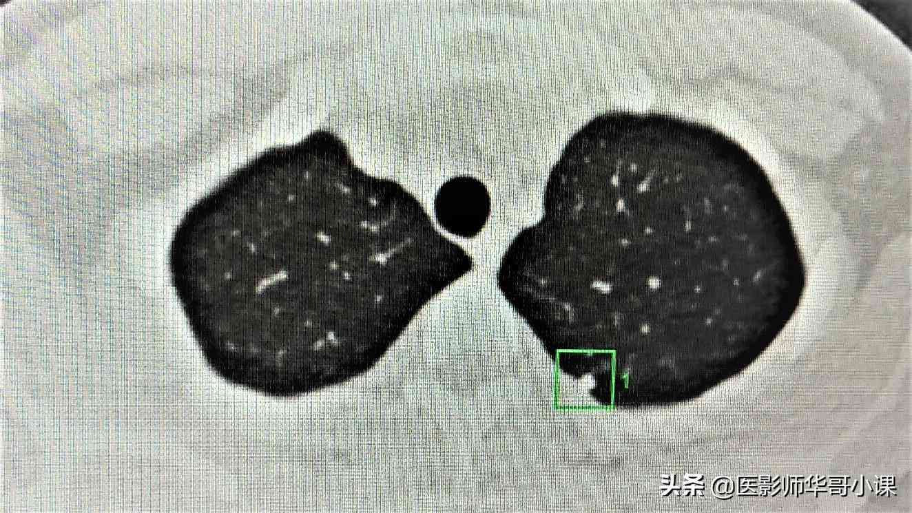 医学影像ai研究进展报告