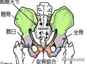 骶髂关节扭伤能认定工伤吗