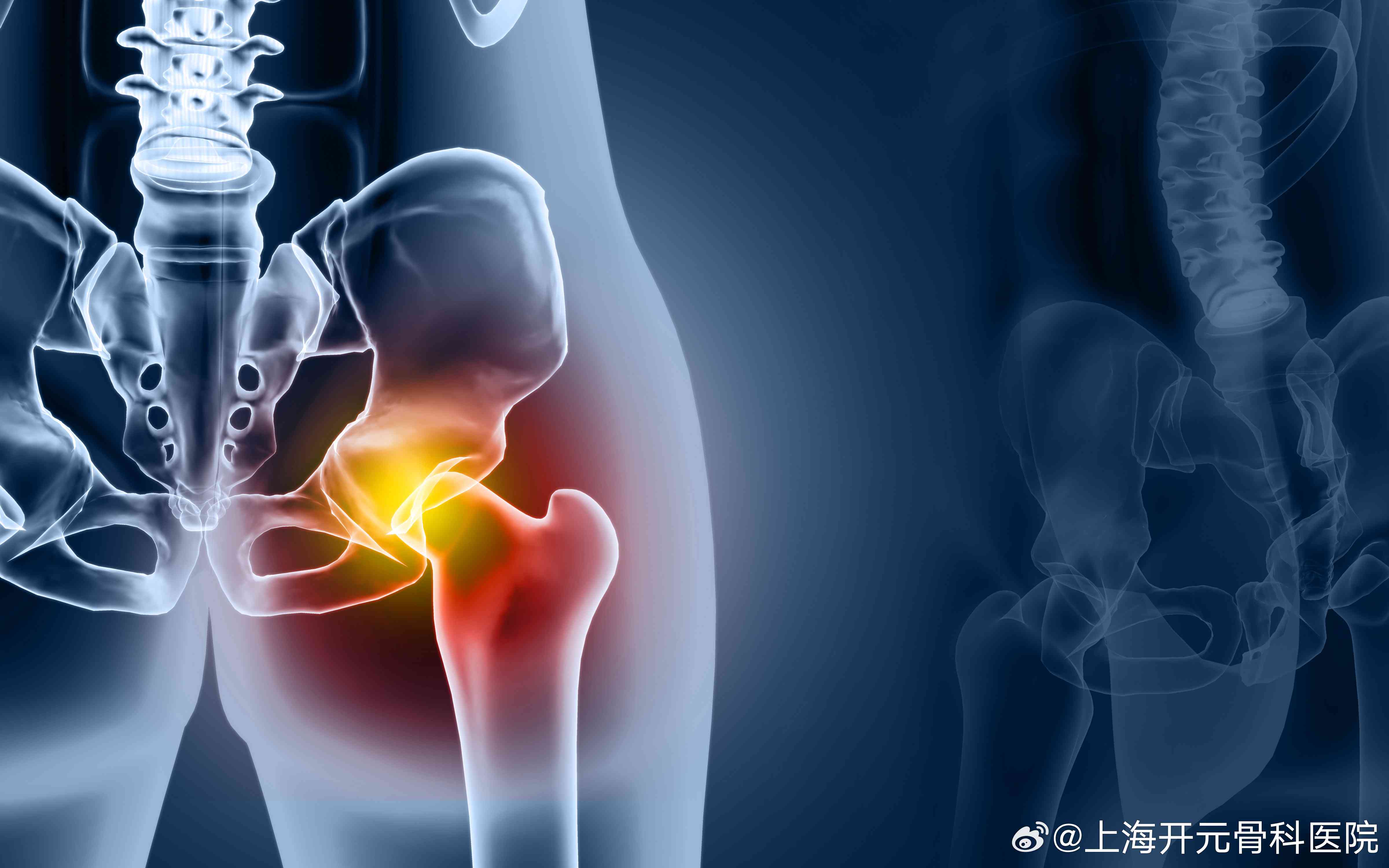 髋关节炎可以认定工伤吗