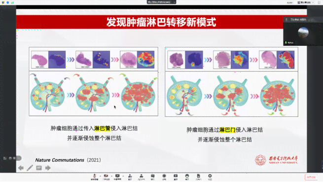 松鼠ai智能传文案模板