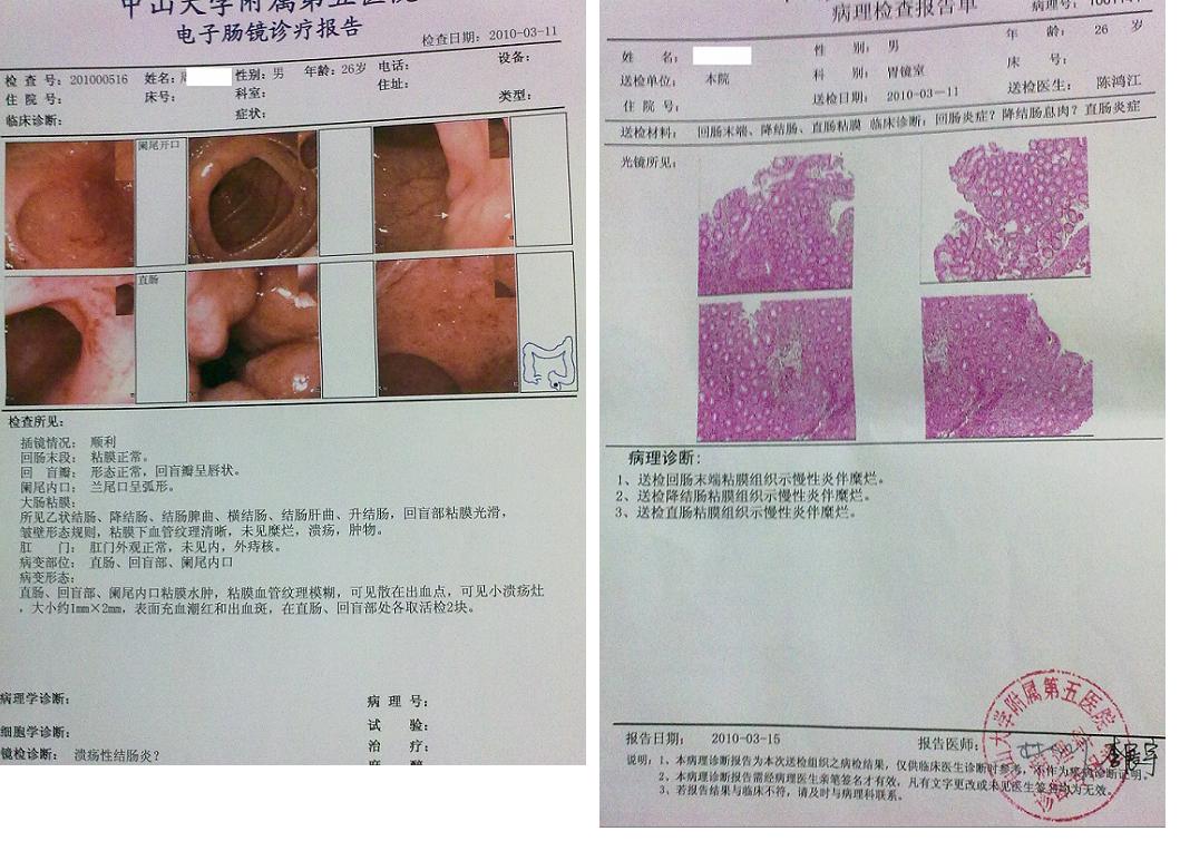 病理报告ai16