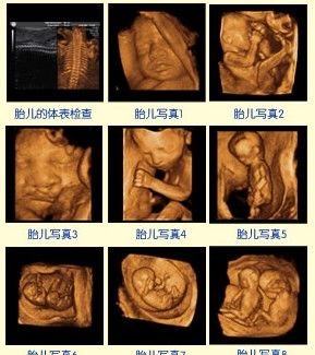 四维彩超ai免费生成文案