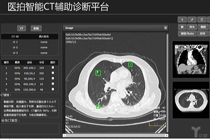 ai医学影像研究报告范文