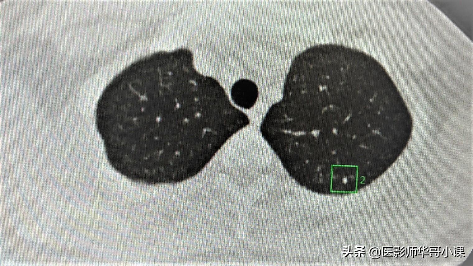 ai医学影像研究报告范文